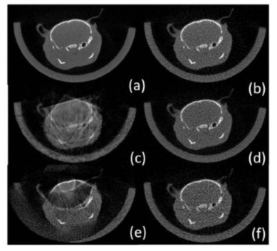 완전한 샘플링된 데이터의 1/4만 사용하는 샘플링 방식으로 POCS 알고리즘을 사용하여 재구성한 쥐의 머리 영상; (a) 참조영상, (b) Sparse-view, (c) bunched sparse-view, (d) MVUS-fine, (e) MVUS-bulk, (f) MVUS-moving