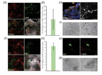 중뇌 오가노이드내 glial 세포 구현