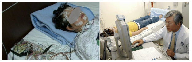 수면의 질을 측정하기 위해 병원에서 시행되는 수면다원검사 (Polysomnography). 수많은 선으로 연결된 센서들이 환자에 부착되고, 얻어진 데이터는 전문가에 의해 수동적으로 검토됨