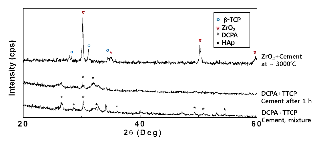 HAp 시멘트와 ZrO2 세라믹간의 초고온(3000℃) 가솔린-산소 torch 실험 후 측정한 x-ray 회절분석 결과