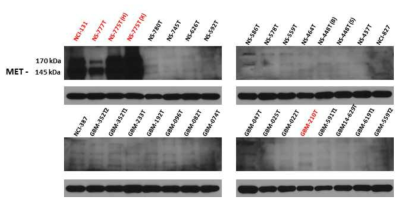 GBM 환자유래세포의 단백질 발현 수준 비교 및 과발현 세포 확인