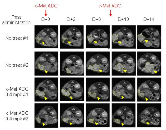 소형동물용 MR 촬영을 통해 c-Met ADC 투여에 따른 마우스 간 내부의 종양 크기 변화를 나타낸 결과 사진 (yellow arrow head: 종양 형성 부위)