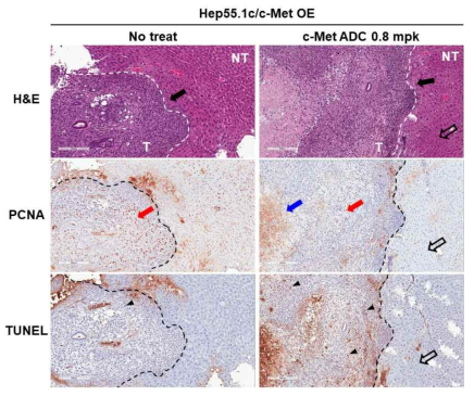c-Met 과발현 Hep55.1c 유래 종양이 형성된 no treat 및 c-Met ADC 0.8 mg/kg 투여 마우스의 간 조직에서 H&E, PCNA 및 TUNEL 조직 염색 사진 (T: tumor, NT: non-tumor, black arrow: tumor leading edge, red arrow: PCNA positive cells, blue arrow: necrotic cells, black arrow head: TUNEL positive cells, black open arrow: adjacent normal liver region)