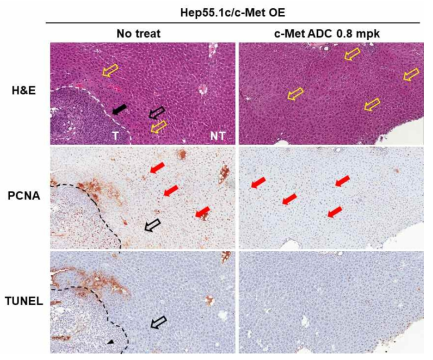 c-Met 과발현 Hep55.1c 유래 종양이 형성된 no treat 및 c-Met ADC 0.8 mg/kg 투여 마우스의 간 조직에서 H&E, PCNA 및 TUNEL 조직 염색 사진 (T: tumor, NT: non-tumor, black arrow: tumor leading edge, red arrow: PCNA positive cells, black arrow head: TUNEL positive cells, black open arrow: adjacent normal liver region, yellow open arrow: abnormal liver cells)