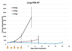 방사선에 의한 재발 폐암 PDX model 구축
