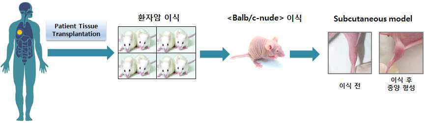 간암, 폐암 PDX model 구축