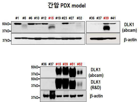 간암 PDX model 16 케이스에서 DLK1 발현 여부