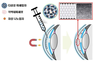 자력유도다공성 미세 세포전달시스템 내 각막내피세포의 분화 제어를 통한 각막 내피 재생효과 향상 연구의 개요. 빨간 네모 표시 안의 사진은 정상 각막내피세포가 보이는 6각형 구조를 나타낸 모식도와 현미경 사진임