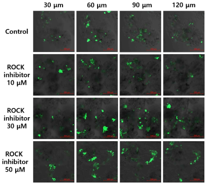 ROCK inhibitor Y-27632가 다양한 농도(10, 30, 50 μM)로 첨가된 배지 조건에서 다공성 PLGA 미세세포전달시스템 내 부착된 각막내피세포를 다양한 깊이에서 관찰한 모습