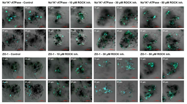 다양한 농도의 ROCK inhibitor Y-27632가 다공성 미세 세포전달시스템 내 담지된 각막내피세포의 분화 상태에 어떠한 영향을 주는지 immunocytochemistry를 통해 평가한 결과. 윗줄의 사진은 각막내피세포의 Na+-K+ ATPase의 형광 발현을 관찰한 것이며, 아랫줄의 사진은 ZO-1의 형광 발현을 관찰한 것임. 각 미세 입자에 탑재된 각막내피세포의 형광 발현을 다양한 깊이에서 관찰하였음