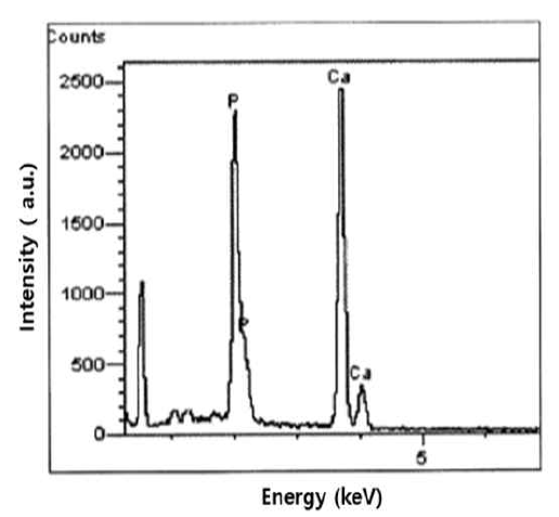 The result of an energy dispersive spectrometer analysis of particles derived from goose-beak bone