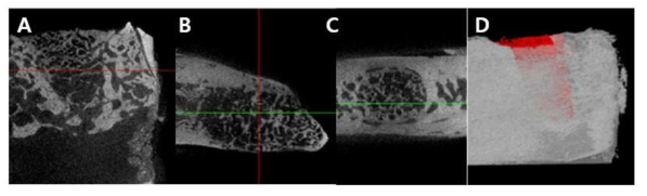 Micro-CT images of 8 weeks post-insertion of goose-beak particles in canine dental sockets. Transaxial (A), sagittal (B), coronal (C), and 3D images (D)