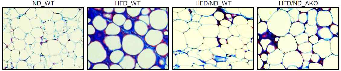 고지방식이로 비만을 유도한 WT과 HIF2α AKO 마우스에서 정상식이 전환 후 내장지장조직(eWAT)에서 trichrome 염색을 통한 섬유화 측정