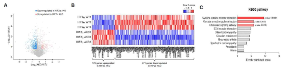 WT 생쥐와 HIF2α AKO 생쥐의 지방조직의 transcriptome에 대한 volcano plot 및 DEG 유전자 발현 패턴, DEG 유전자에 대한 KEGG pathway 분석 결과