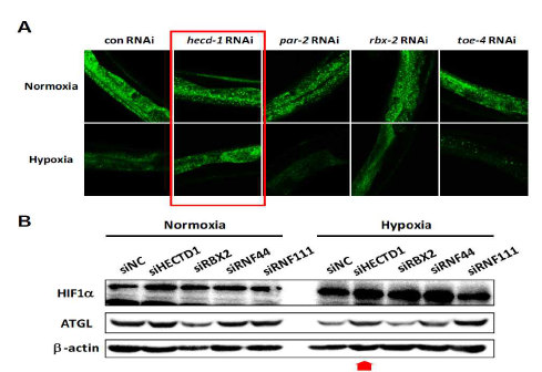 HECTD1 (hecd-1) E3 ligase knockdown에 의한 저산소 의존적 ATGL 단백질 감소의 회복