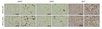 고지방식를 섭취한 HIF2α AKO 생쥐 지방조직의 H&E 염색 결과