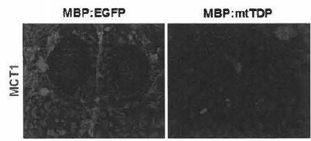 희소돌기아교세포 특이적으로 mt TDP 유전자 발현하는 형질전환 제브라피쉬에서 MCTl의 발현 레벨이 감소함을 확인함
