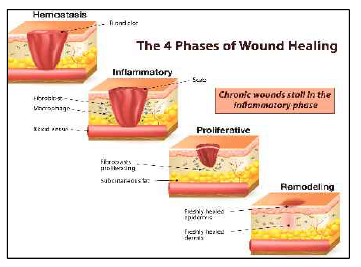 Phase of normal wound healing