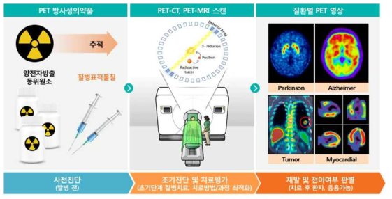 양전자방출 단층촬영술을 이용한 질병 진단