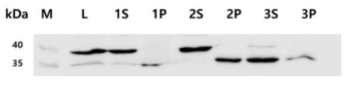 단백질 분리 과정별 Western blotting결과