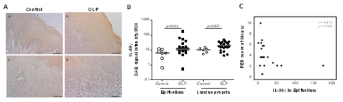 대조군과 구강편평태선 병소조직에서 IL-36γ 발현. A, 대표적 이미지. B, 각 샘플을 상피층과 고유층으로 나누어 4개 영역을 사진 찍은 후 IL-36γ 발현정도를 정량한 그래프. C, 구강편평태선에서 상피층의 IL-36γ 발현량과 임상증상 심도(REU score) 간의 상관관계
