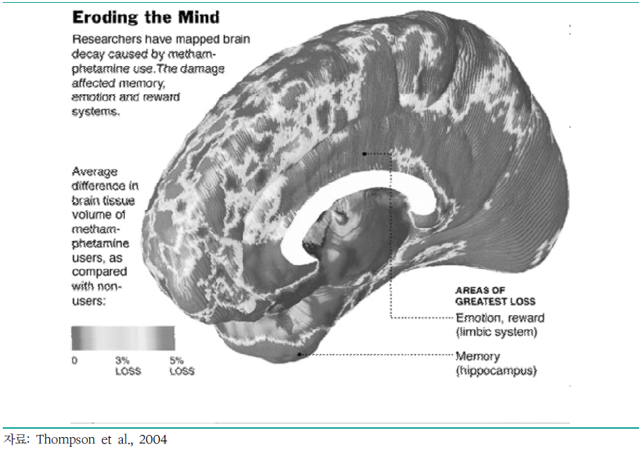 메스암페타민에 의해 파괴되는 뇌의 부위