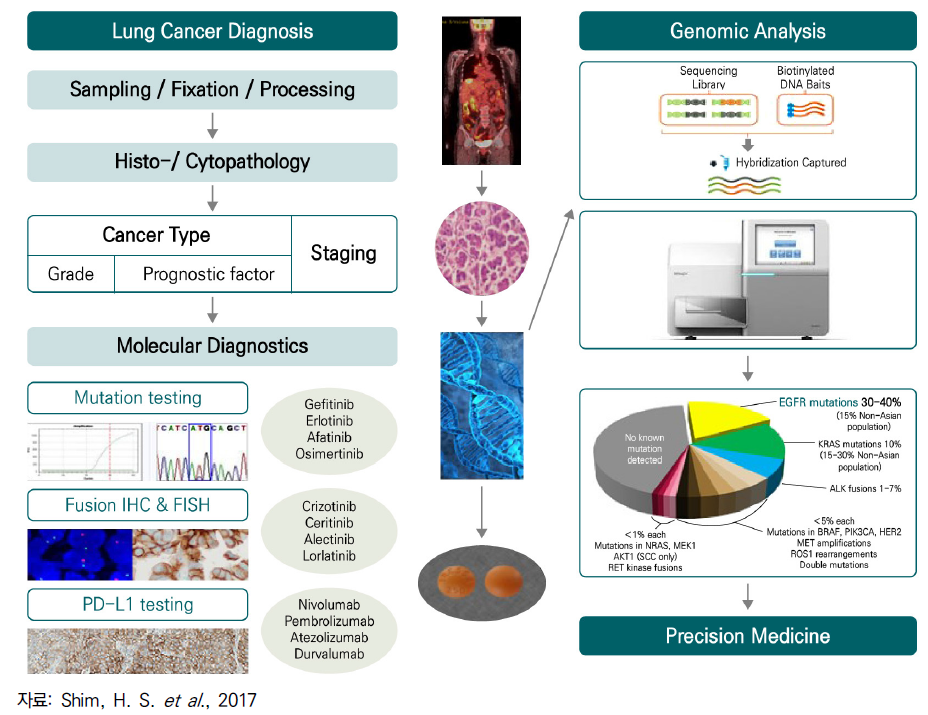 폐암의 진단 및 유전체 분석 모식도