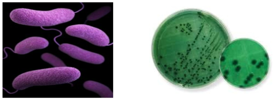 장염 비브리오 유발 세균(Vibrio parahemolyticus)과 TCBS 선택배지