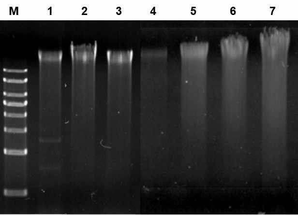 16s rRNA 동정을 위한 각 균의 genomic DNA 추출 후 전기영동