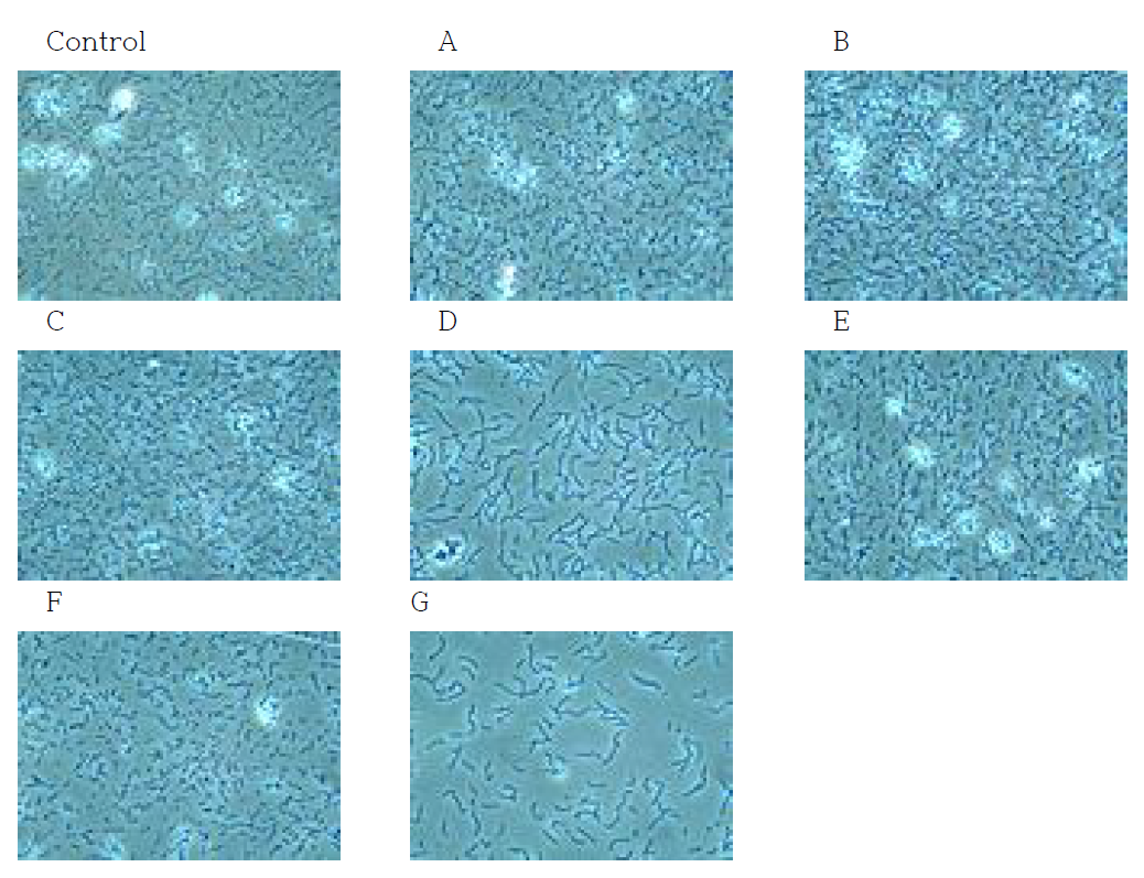 다양한 배지 조건에서 배양된 MG4502의 현미경 관찰(× 1,000)