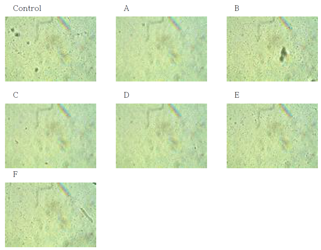 다양한 배지 조건에서 배양된 MG4524의 현미경 관찰 (× 1,000)