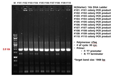 ctg5574_31 클론의 PCR 확인 결과