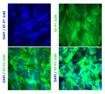 HBEC 세포주를 이용한 KF-P1, KF-P2의 F-actin 형광표지 비교