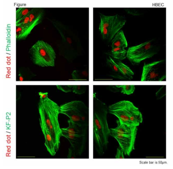 HBEC 세포주를 이용한 KF-P2의 F-actin 공초점 레이저 주사 현미경 형광표지 이미지