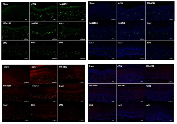 세균성 질염 마우스의 질 조직 형광분석 결과 Fluorescence IHC image of vaginal tissue (original magnification x 100). Vaginal tissues were fixed, embedded in paraffin, sectioned, followed by staining with the antibody of TNF-α (up) and F4/80 (down)