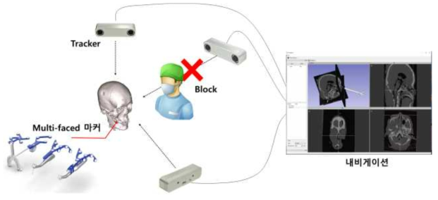 다중 위치추적장치를 사용하여 환자와 수술도구를 트래킹하며, 사람에 의해 block이 발생할 경우 그 중 하나만 작동되어도 트래킹이 부드럽게 지속될 수 있도록 시스템 구성
