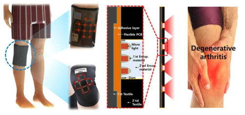 관절 통증 질환 완화에 적용 가능한 Micro-LED 웨어러블 케어용 시제품 예