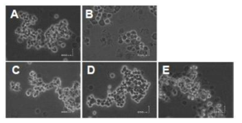 PC12cell에서 세포독성을 유도하는 아밀로이드 베타에 대한 치자추출물과 그 정제 활성물질P의 효과 (A) 정상대조군 (B) 10μM Aβ25-35 (C) 100μM Vit. C + 10μM Aβ25-35 (D) 치자추출물 + 10μM Aβ25-35 (E) 치자의 정제 활성물질 P + 10μM Aβ25-35