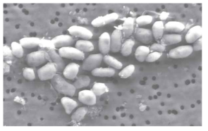 비소 함유 미생물(GFAJ-1)의 전자현미경 사진 (SEM)