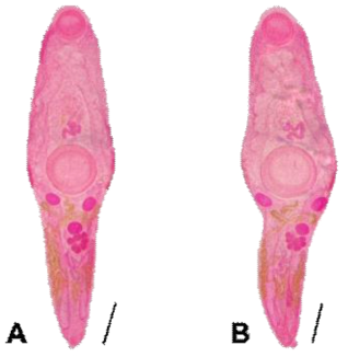 Mature specimens of Hysterolecithoides epinepheli Yamaguti, 1934 from Signus fuscescens (Mottled spinefoot). A and B. ventral views. Scale bars: 500 ㎛