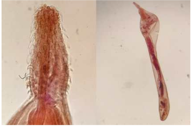 Photomicrograph of Corynosoma strumosum. Left: Everted proboscis, Right: Whole body