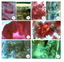 Micrographs of Mesenchytraeus racemosus n. sp