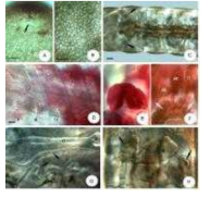 Micrographs of Mesenchytraeus jumbongensis n. sp