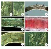 Micrographs of Decimodrilus bulbosus n. sp