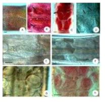 Micrographs of Fridericia sphaericoides n. sp
