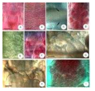 Micrographs of Fridericia granulocytoides n. sp