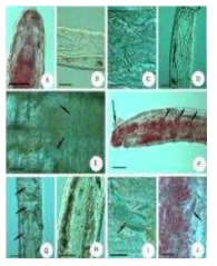 Micrographs of Marionina seminuda Xie & Rota, 2001