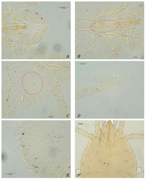 Photomicrograph of Balaustium murorum Hermann; A. Palptibial claw; B. Crista; C. Talsus I; D. Urnula; E. Shape of Dorsal seta; F. Ventral surface of gnathosoma and coxa I, II. Scale bars: 50 μm
