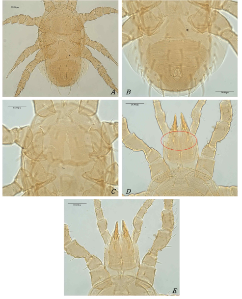 Photomicrograph of Lasioseius floridensis Berlese (♀) ; A. Dorsal view; B. Ventral view(Genital, Anal plate); C. Ventral view(sternal plate); D. Tectum; E. Gnothosoma. Scale bars: 50 μm