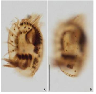 Photomicrograph of Certesia quadrinucleata protargol impregnated individual. A. Ventral ciliature. B. Dorsal kineties. Scale bar = 20 μm